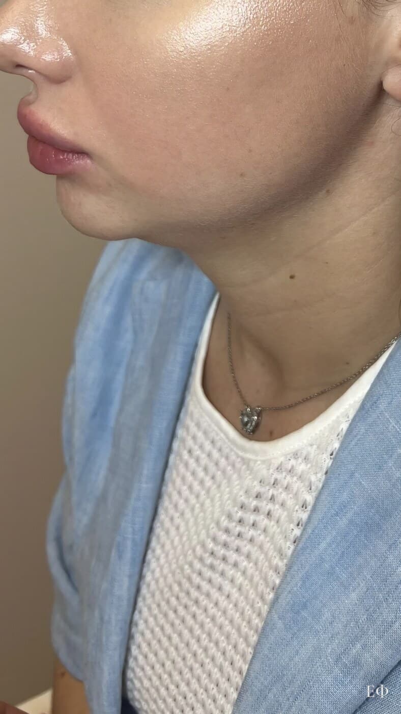 До — FullFace, фото 1