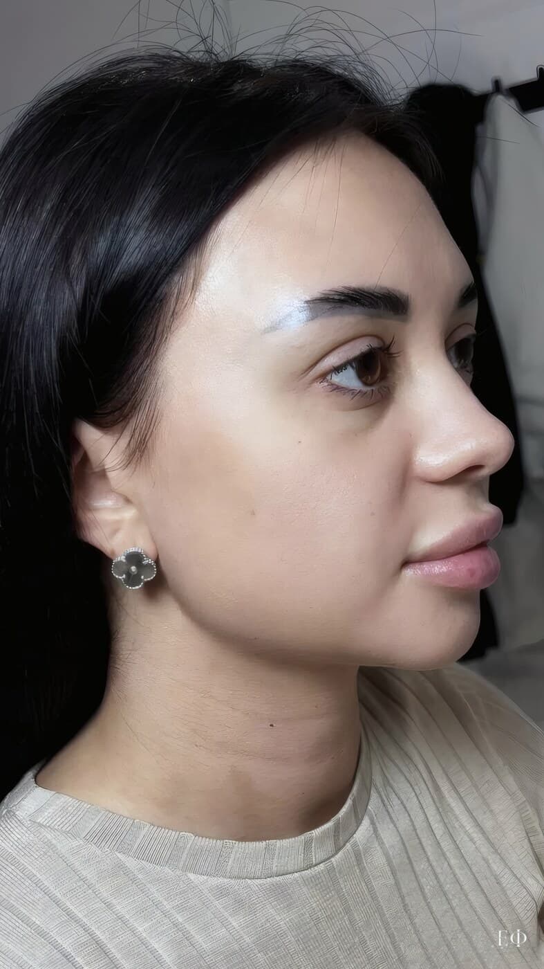 До — FullFace, фото 2